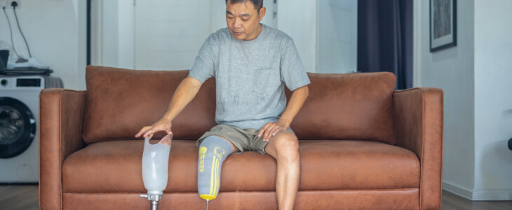 Man sitting on sofa holding prosthetic leg